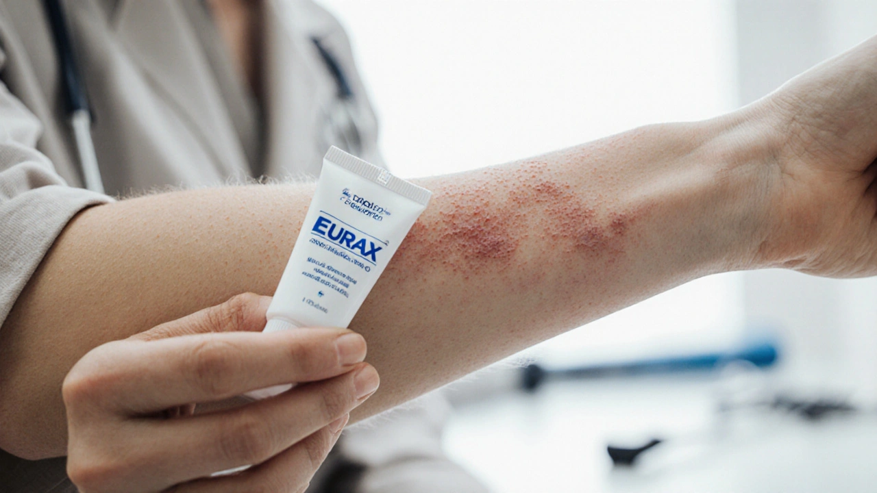 Eurax (Crotamiton) vs Other Scabies Treatments - Full Comparison